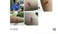 女子爆料城管打人视频播放